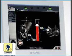 Slider image (8) Dr. Narendra Vaidya | Joint Replacement Specialist